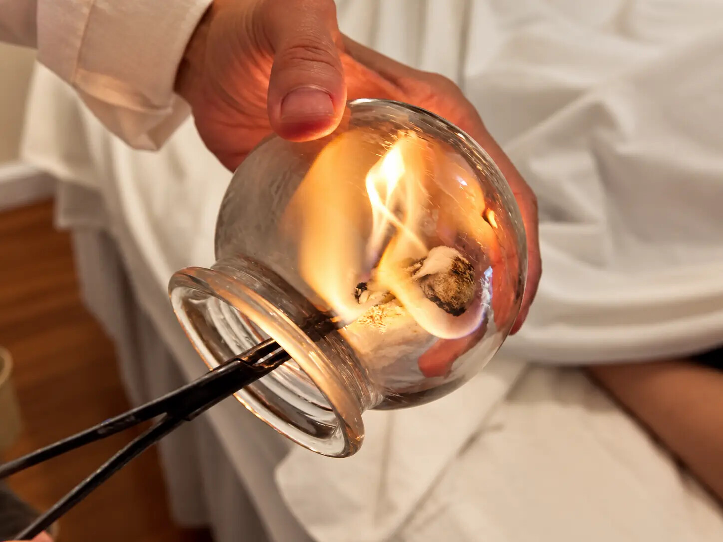 A practitioner preparing a glass cup for traditional fire cupping